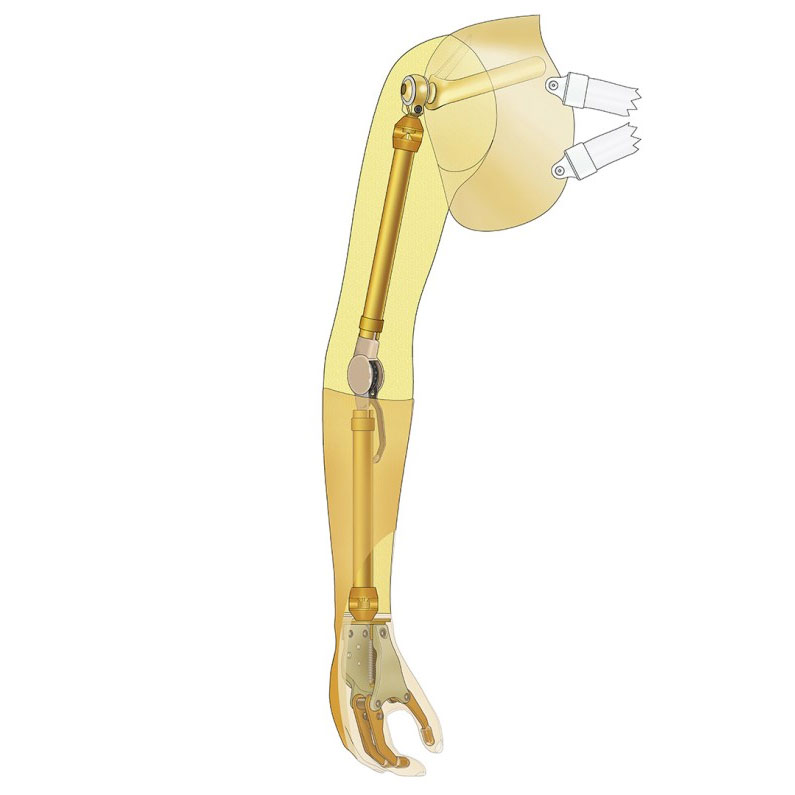 装饰型上肢被动假肢